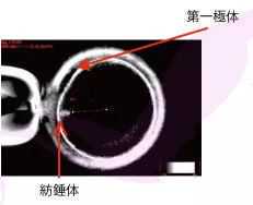 2026年烟台做三代试管包生男孩真实费用清单大揭秘